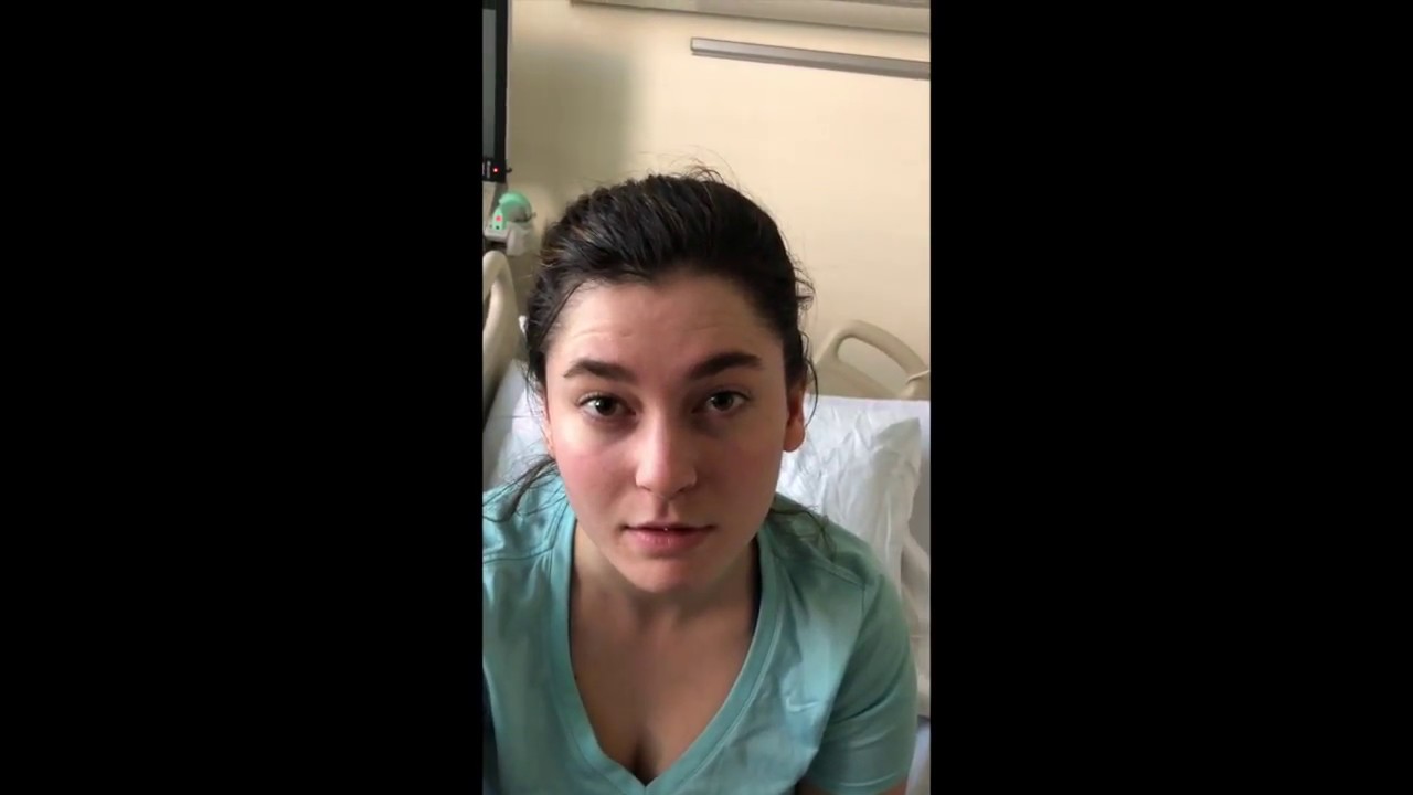 Oculogyric Crisis — Dystonic Reaction