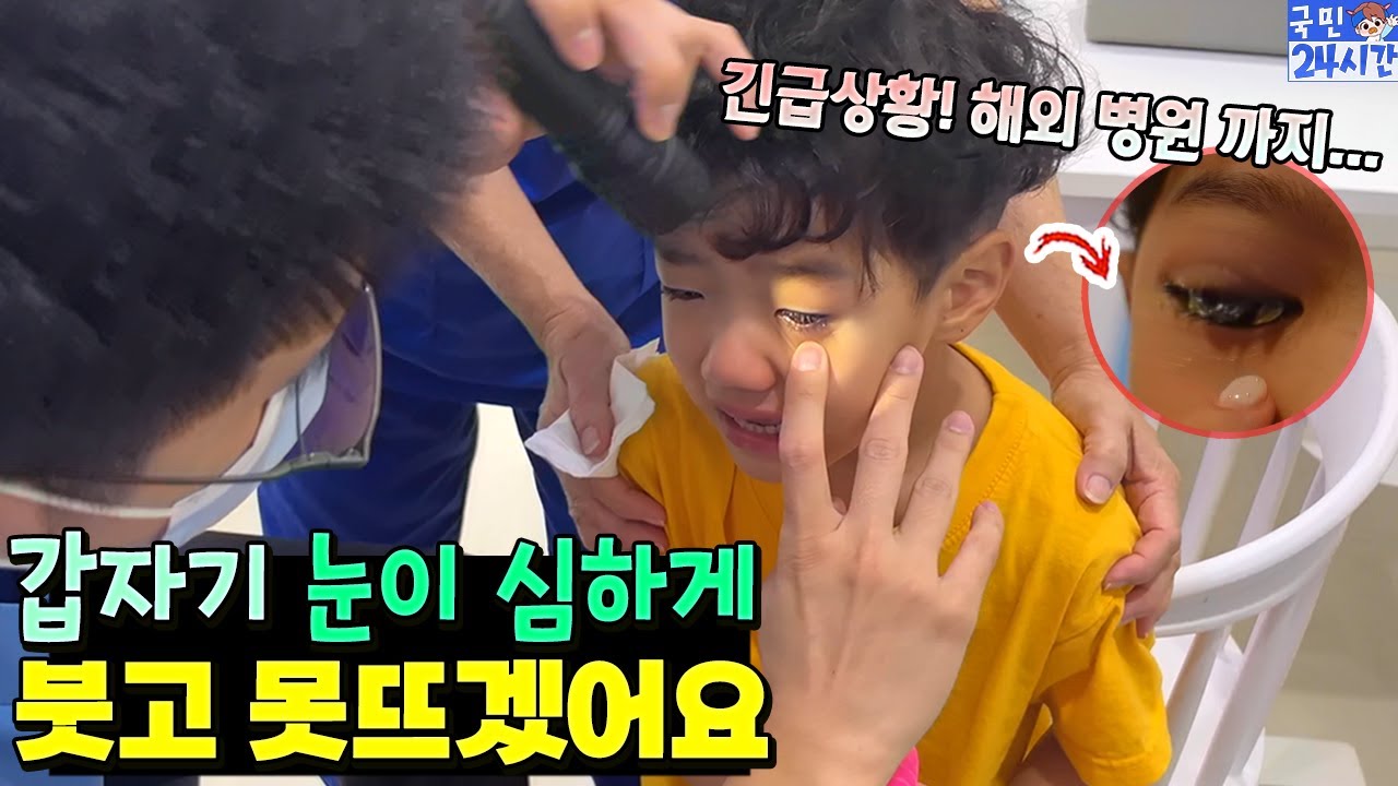 갑자기 눈이 심하게 붓고 못뜨겠어요ㅠ 해외에서 병원 가야하는 심각한 상황이... 국민이 24시간 흔한 가족 일상 | 말이야와친구들