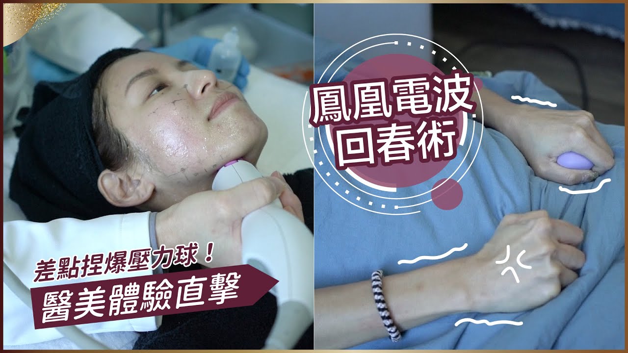 醫美體驗直擊！鳳凰電波真的會回春嗎？♥ Nancy
