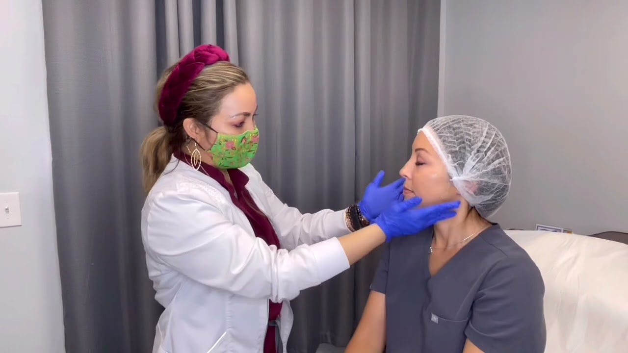 The Consultation Process - Dermal Fillers