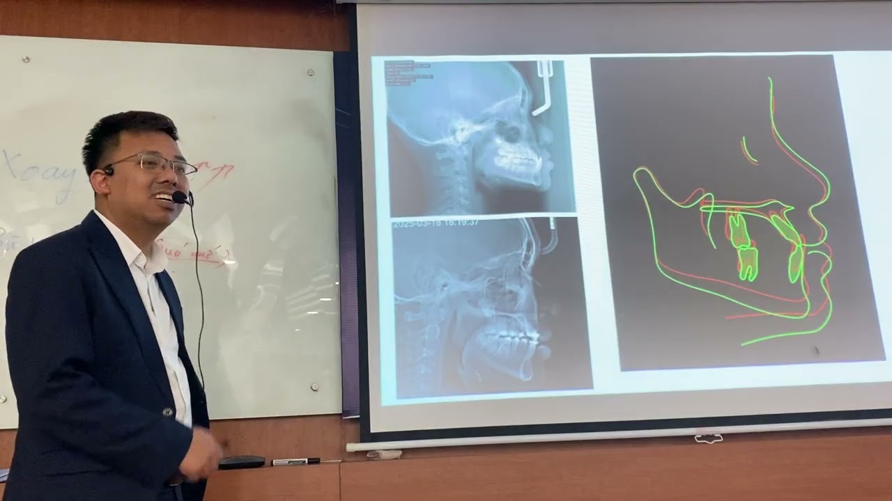 Kiến thức mở rộng Geaw- overlay