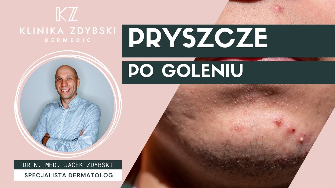 Dermatolog mówi o: pryszcze po goleniu