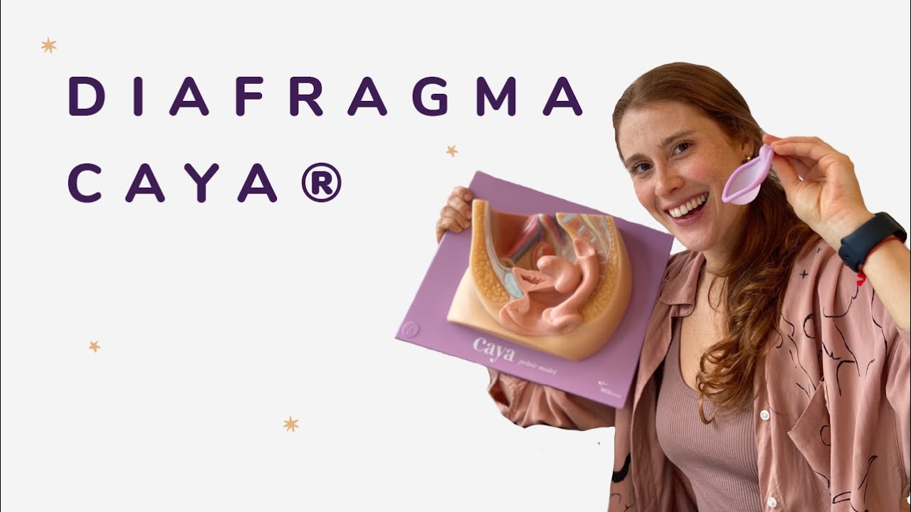 Diafragma - Método anticonceptivo sin hormonas
