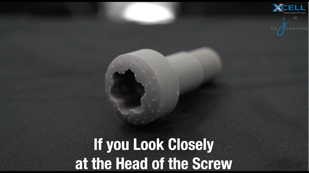 Xcell Dental Implants: What is the PowerBall Screw?