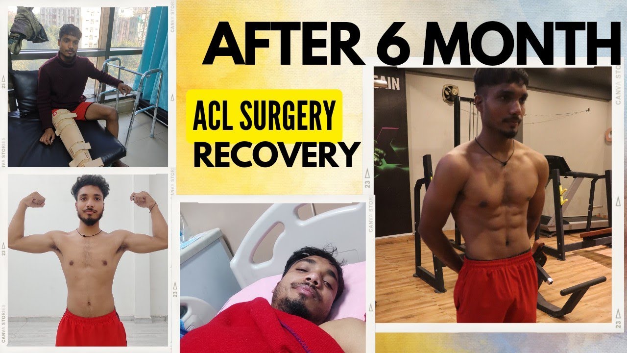 Acl Surgery | 6 month Recovery journey | Ayushman badoniya