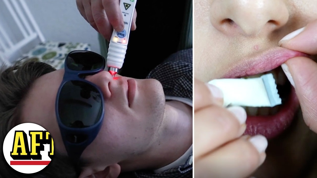 Se när reportern testar snuslaser – för att sluta snusa