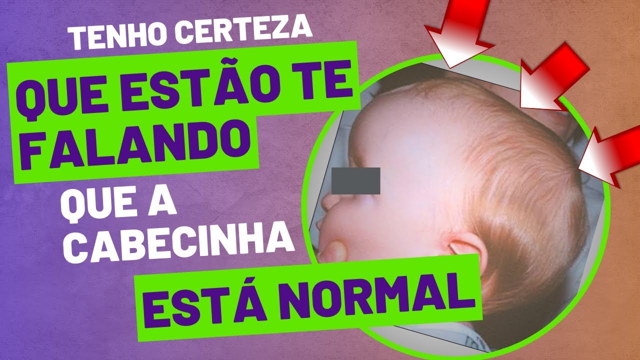 DOENÇA DO BEBÊ que passa DESPERCEBIDA e é GRAVE !