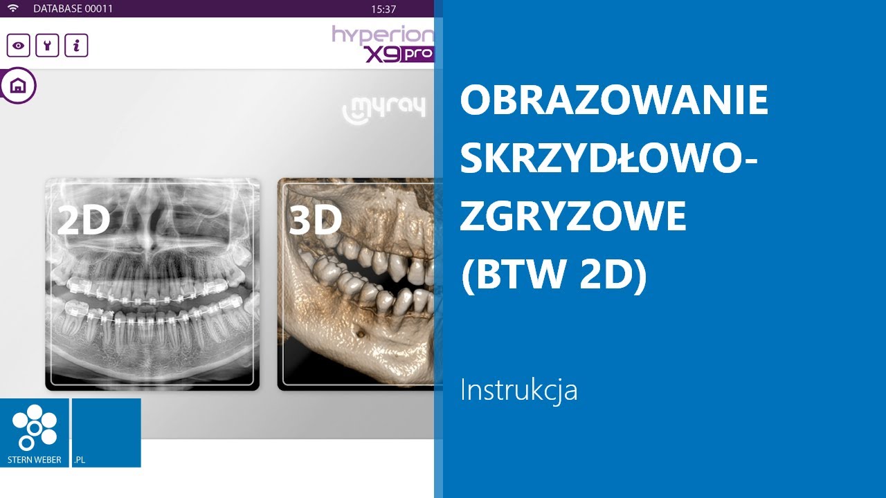 Obrazowanie skrzydłowo-zgryzowe (BTW 2D) | Instrukcja wykonywania badania w MyRay Hyperion X9