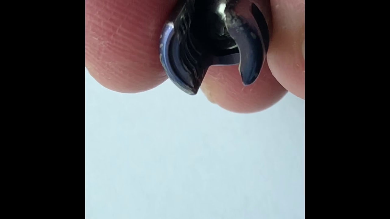 How to remove Millenium spinal pedicle screws