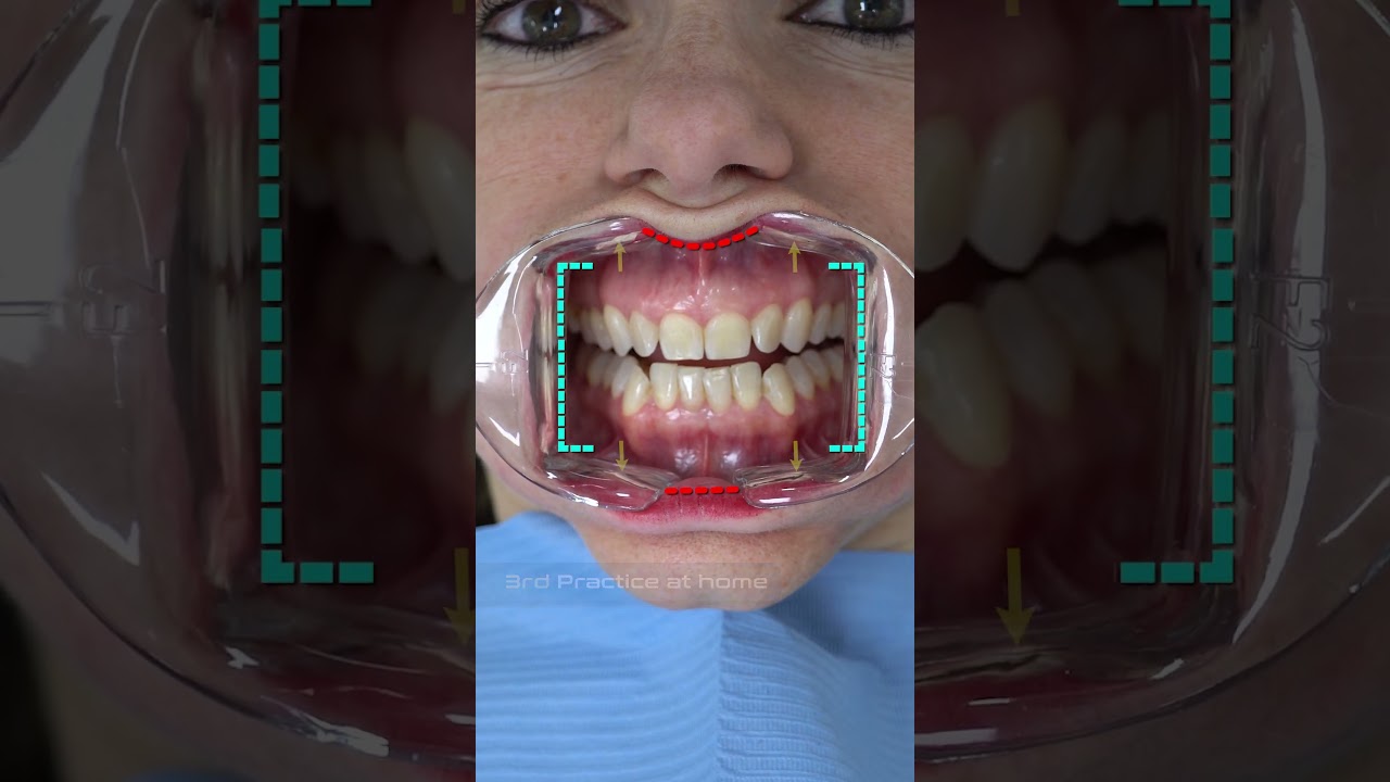 Intraoral Dental Photography Tutorial | Online Course 2024  #dentistry #moderndentistry #shorts