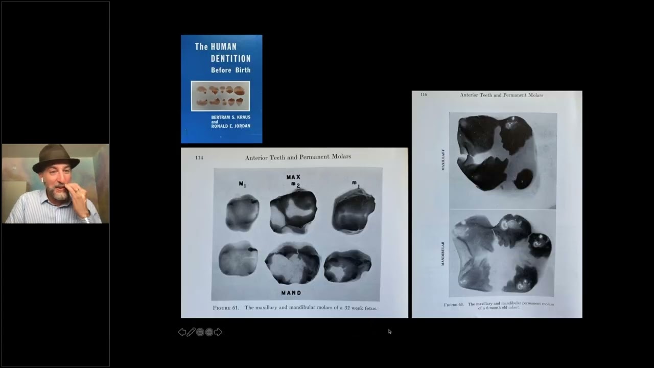 Minimal Interventions to Manage Molar Incisor Hypomineralization