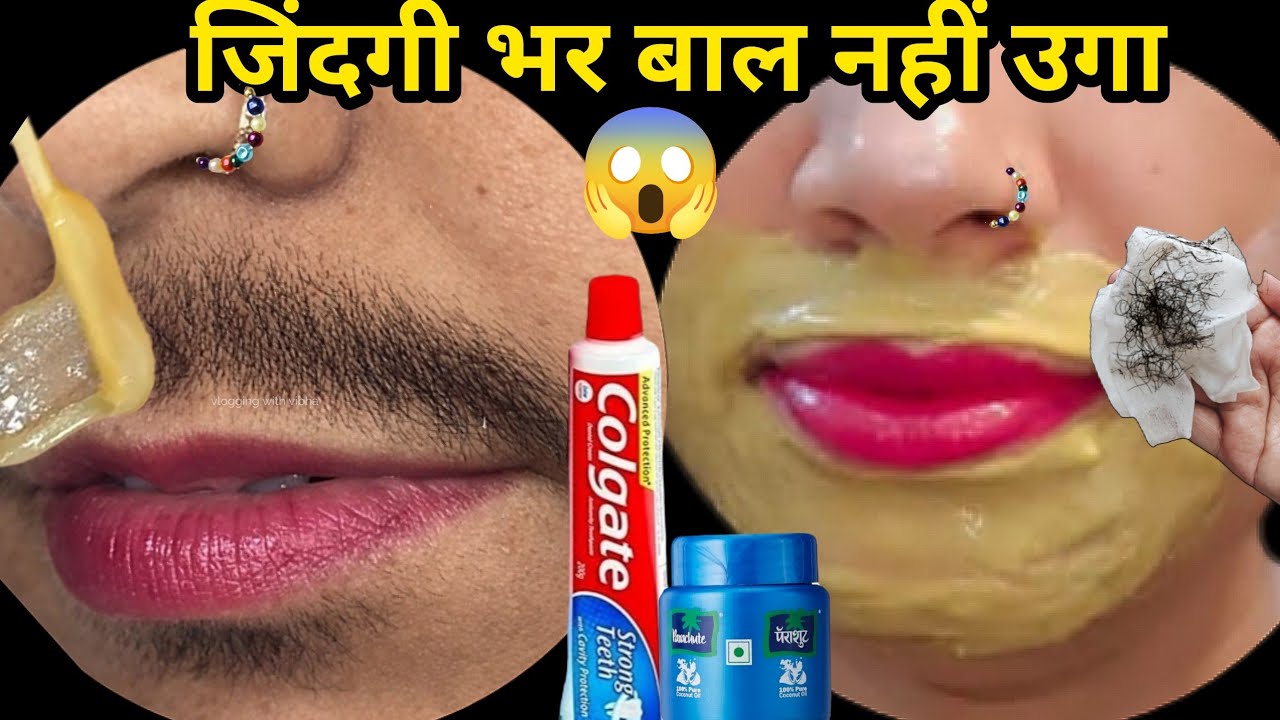 दाढ़ी के बाल से इतना परेशान थी😔दो बूंद लगते ही बिना दर्द निकले😱|| facial hair treatment in Hindi