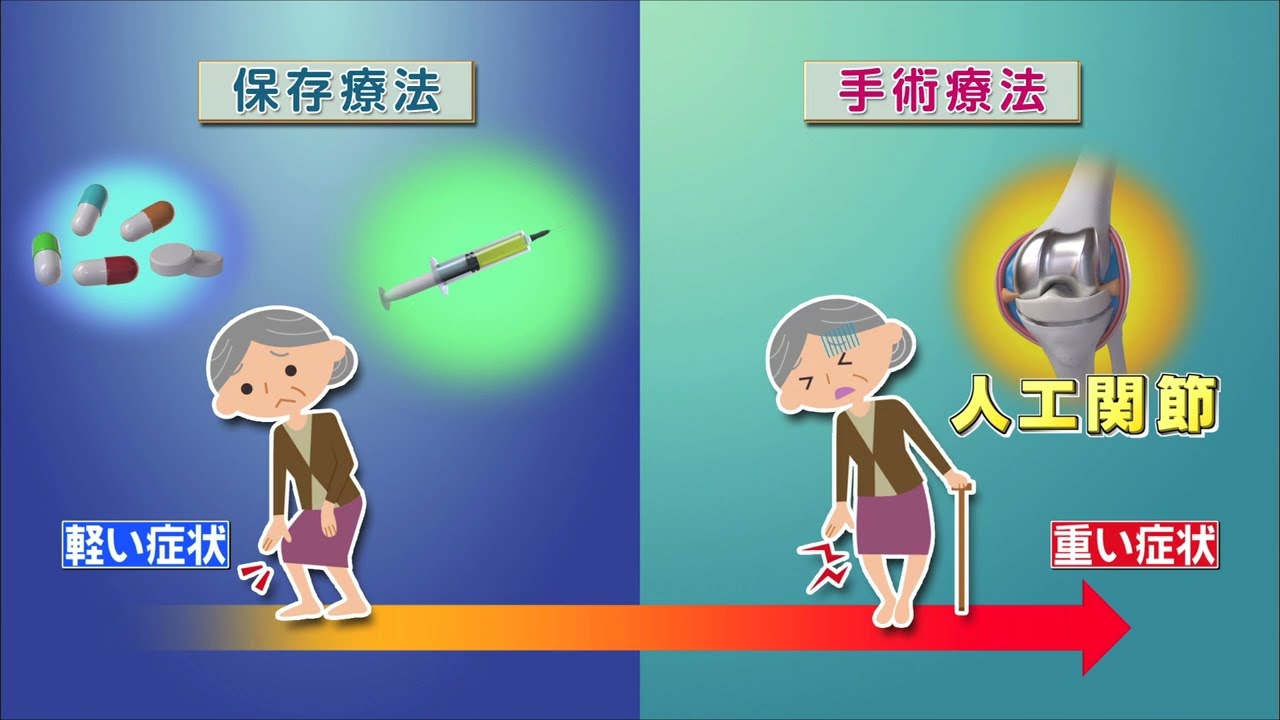 PRP/APS療法を動画で解説