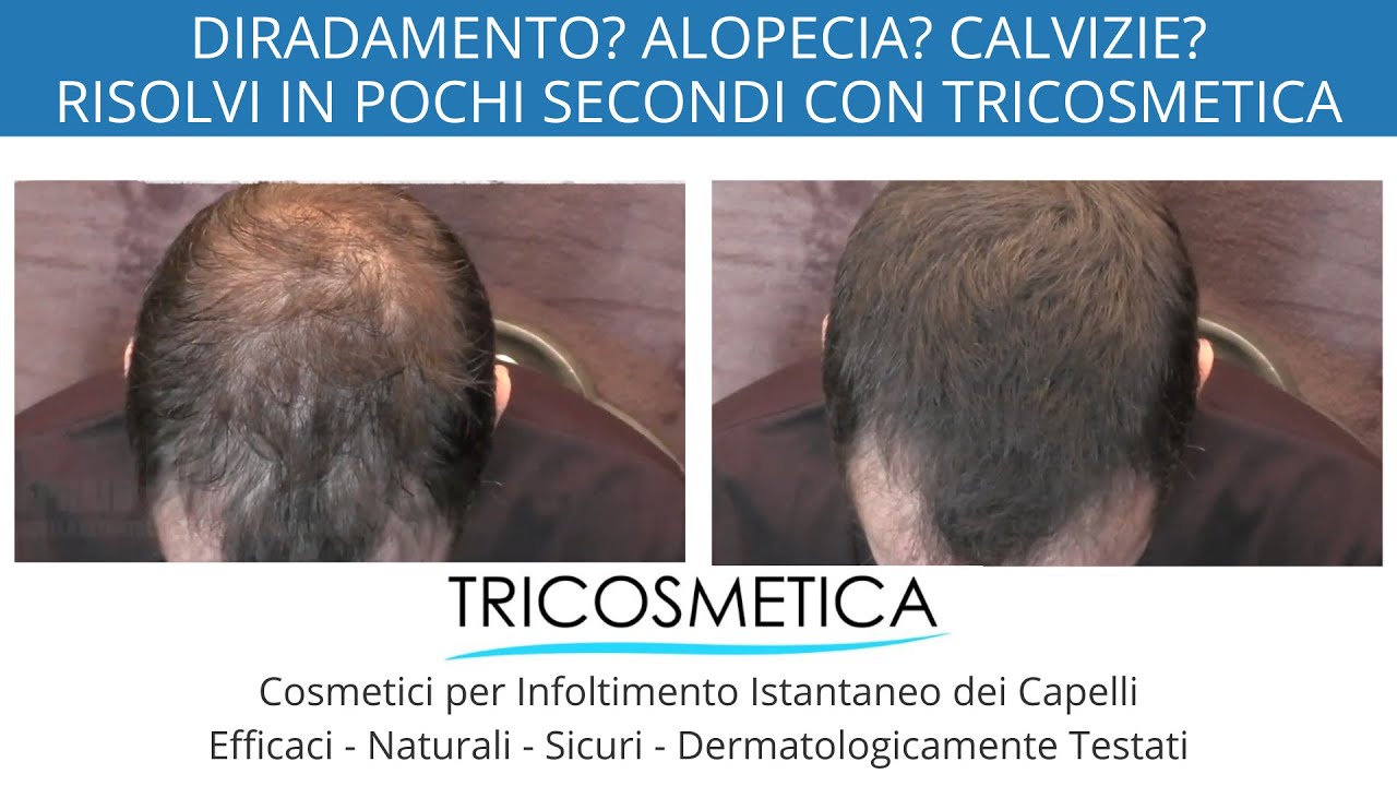 DIRADAMENTO ESTESO? Coprilo In Pochi Secondi Con Dephair di Tricosmetica