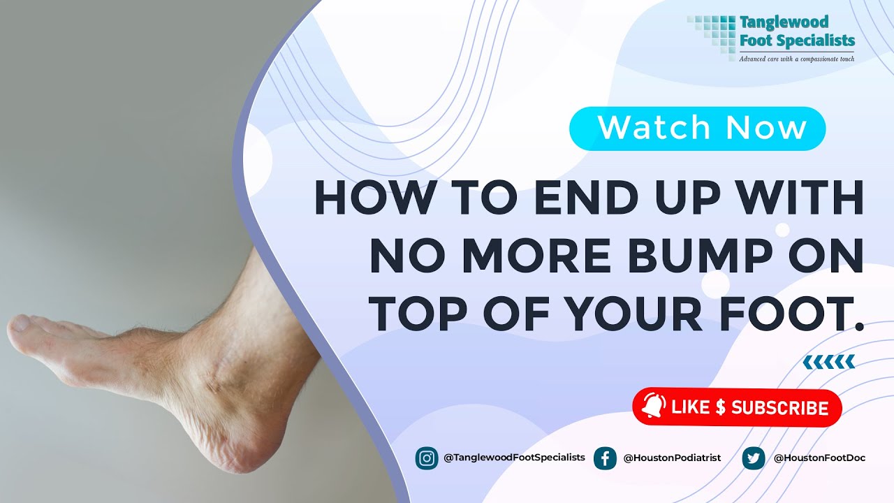 How to End Up with No More Bump on Top of Your Foot