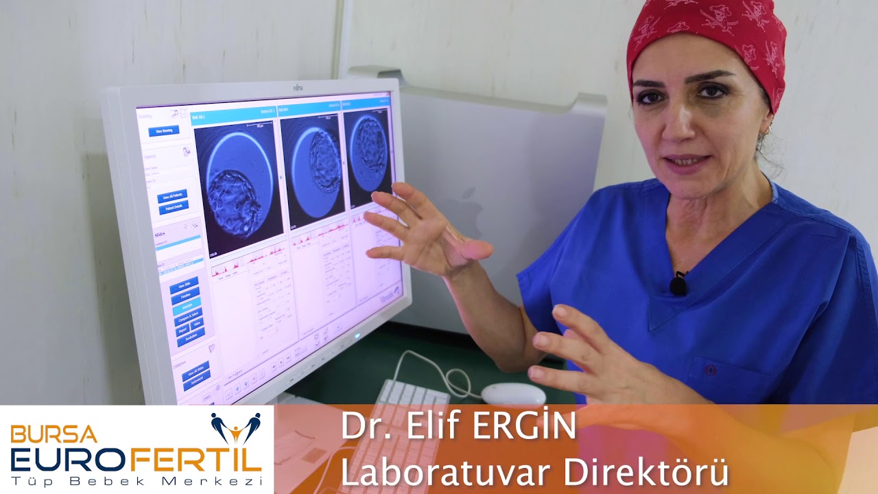 EMBRİYOSKOP #embriyoscope #embriyoskop