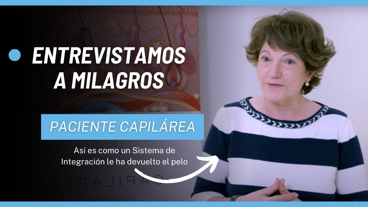 Sistemas de Integración Capilar: así es cómo Milagros recuperó su pelo
