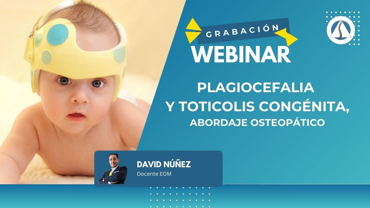 Plagiocefalia y Torticolis congénita. Abordaje Osteopático