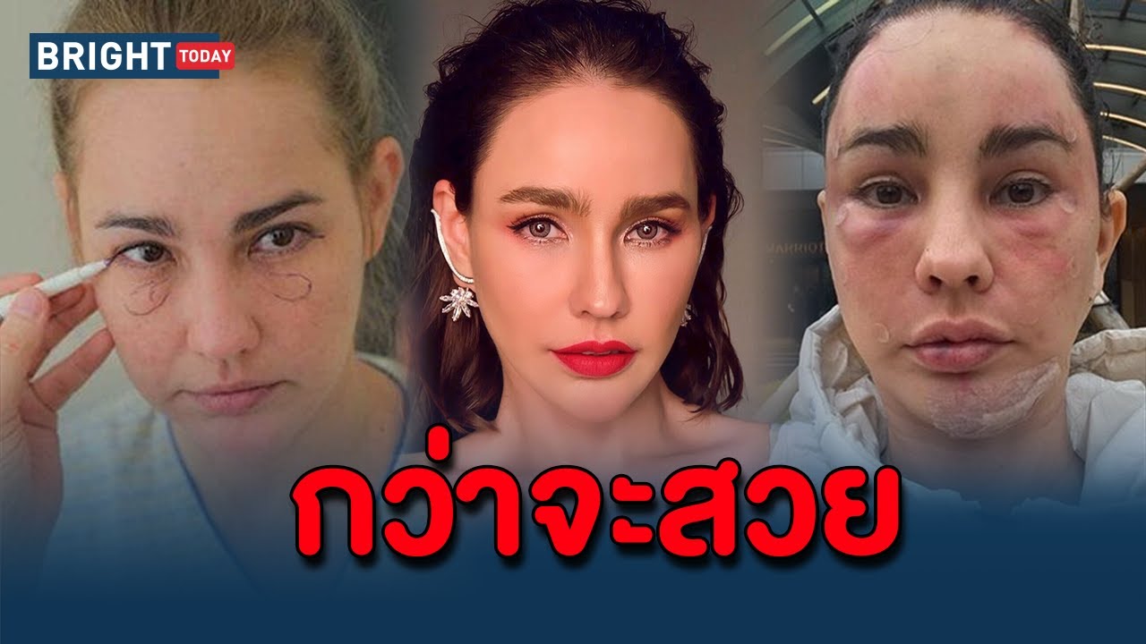 ย้อนดู 