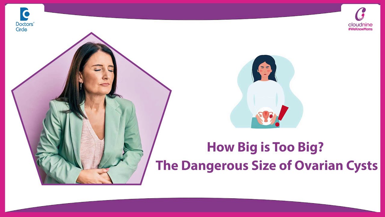 Is an 8 cm Ovarian Cyst Dangerous?  - Dr.  Aruna Kumari | Doctors' Circle