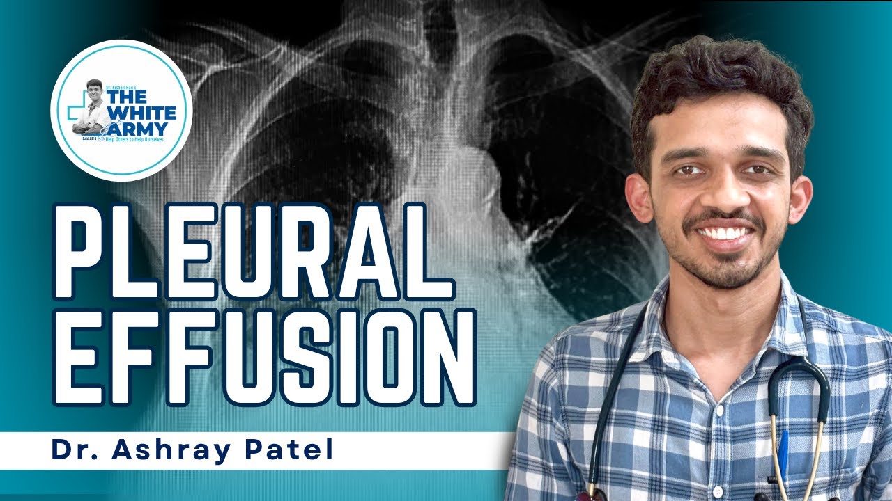 PLEURAL EFFUSION | Dr. Ashray Patel