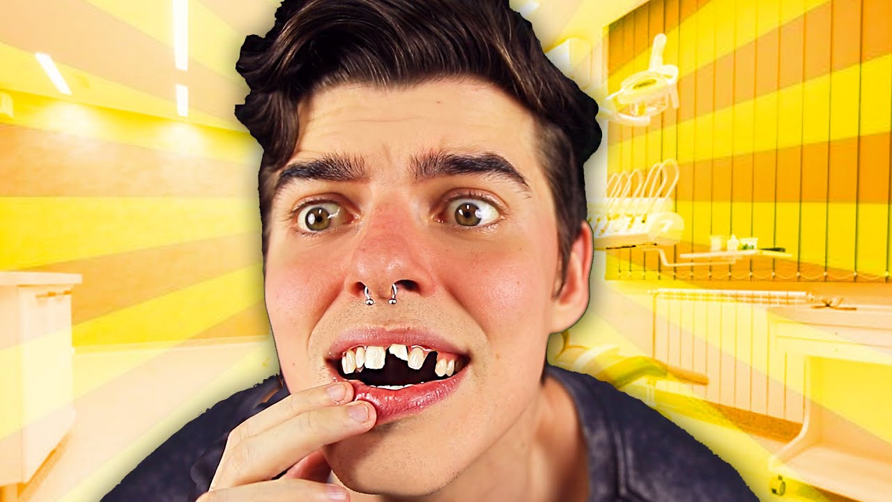 PERDI 3 DENTES FUGINDO da BALADA