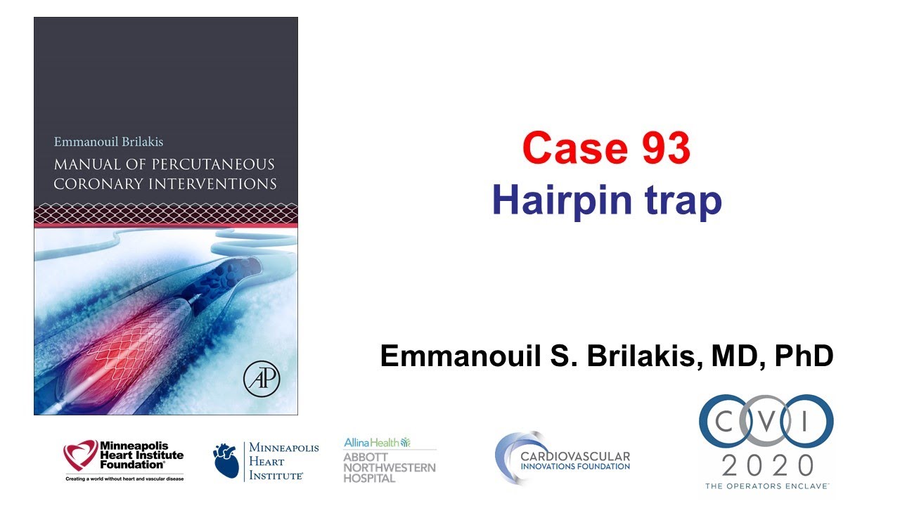 Case 93: Manual of PCI - Hairpin Trap