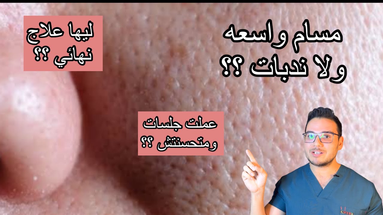 المسام الواسعه بتتعالج نهائيا ؟ ليه جلساتها مش فعاله ؟