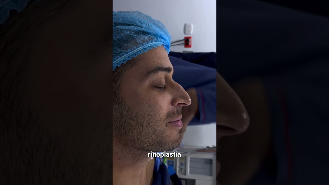 Resultados de rinoplastia minutos después de cirugía   