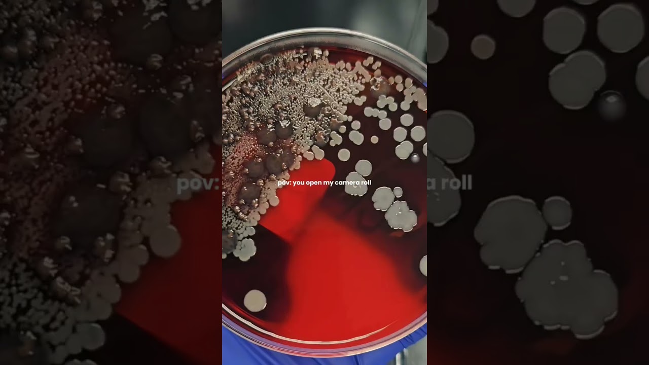 My life as a Medical Laboratory Scientist! #labtech #microbiology #medicalscience #lablife #science