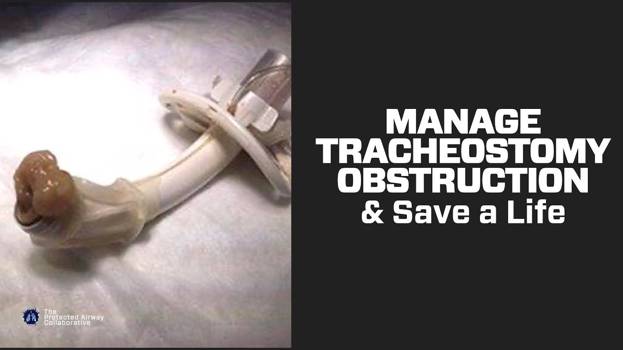 Save a Life. What to Do When a Tracheostomy Tube is Obstructed