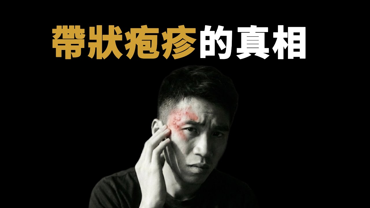 藏在90%的人體內的病毒，為什麼它沒有像天花一樣滅絕，為什麼會讓人這麼疼｜鹿哥Gustav