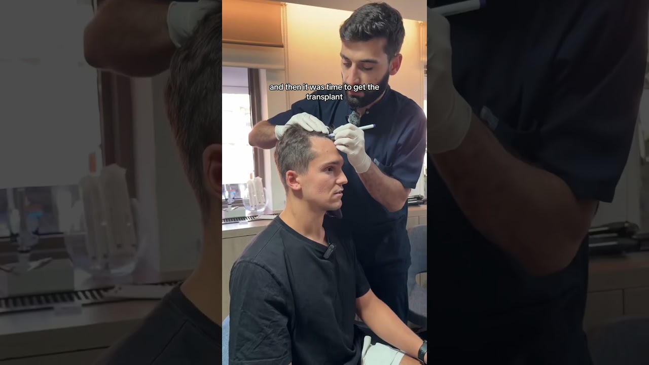 I went to turkey for a hair transplant #EsteNovePartner