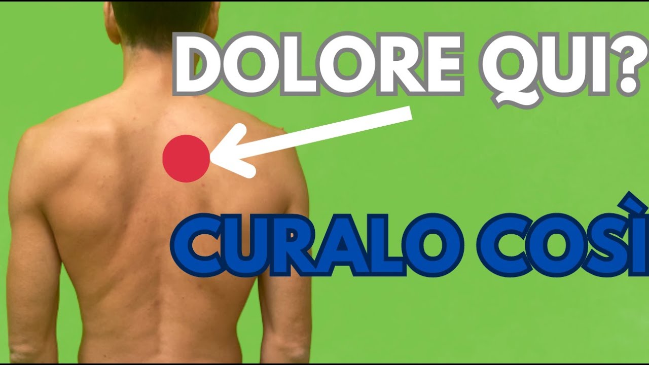 CONTRATTURA ai romboidi? Cosa fare per RISOLVERE.