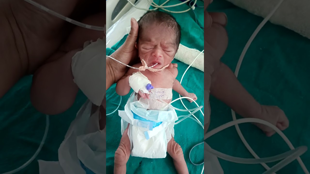 #newborn #premature #cutebaby