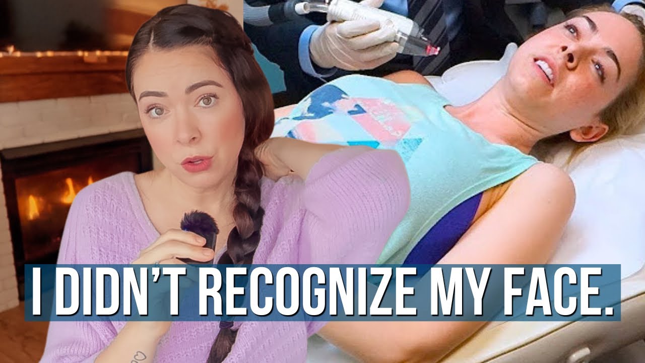 Я попробовала ботокс… И произошло что-то странное.