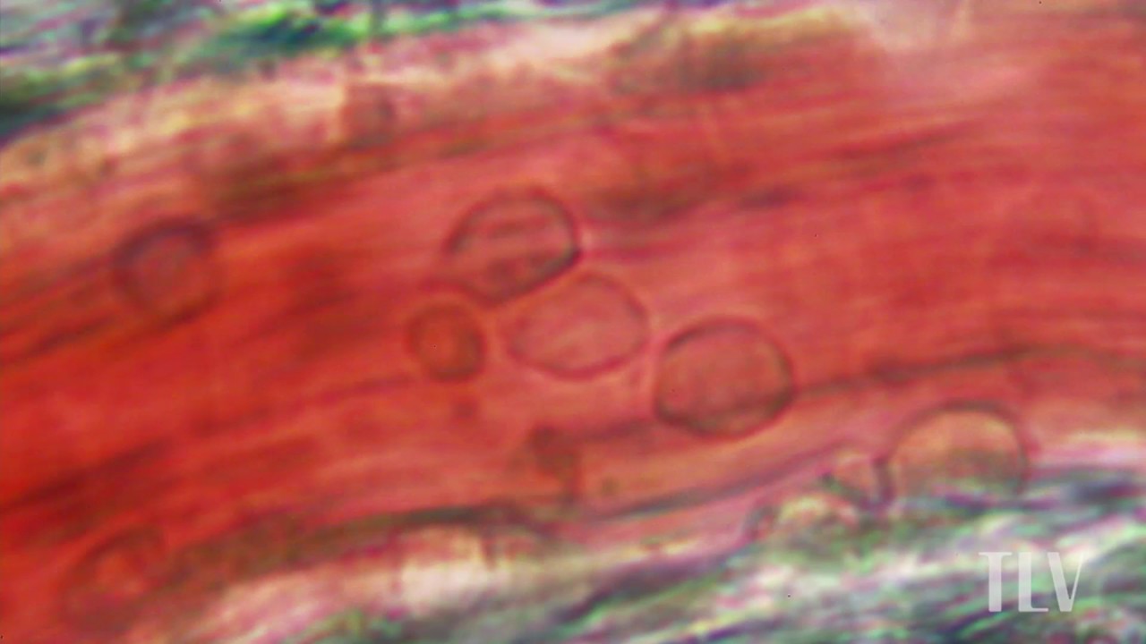 Leukocyte transmigration -白血球の血管外への移動（遊出）-