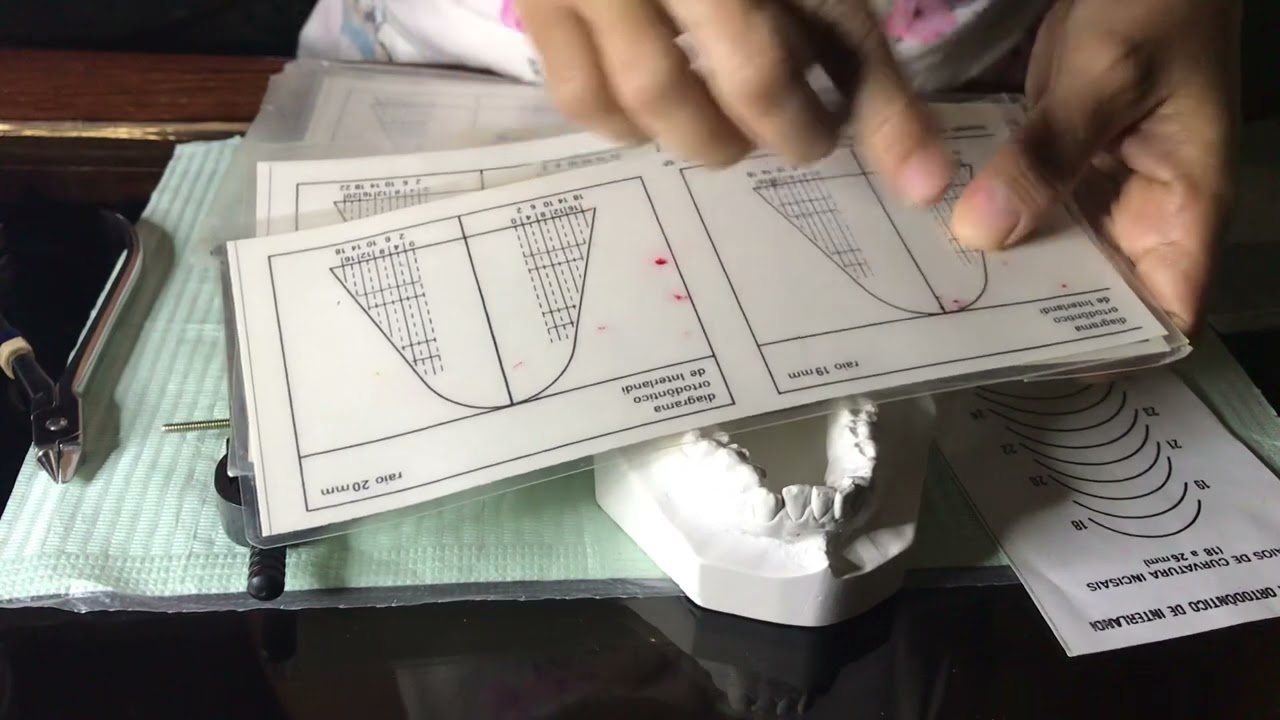 Importancia de diagramar arcos de ortodoncia