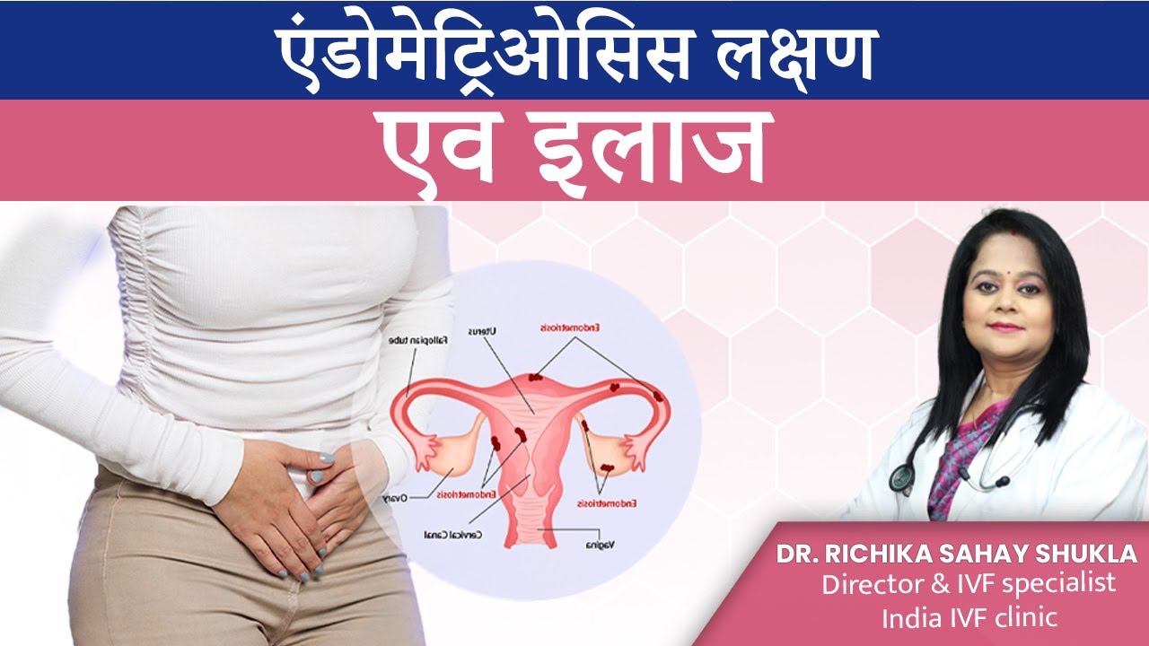 एंडोमेट्रिओसिस : लक्षण एव इलाज - Endometriosis Symptoms & Treatment - Dr. Richika Sahay Shukla
