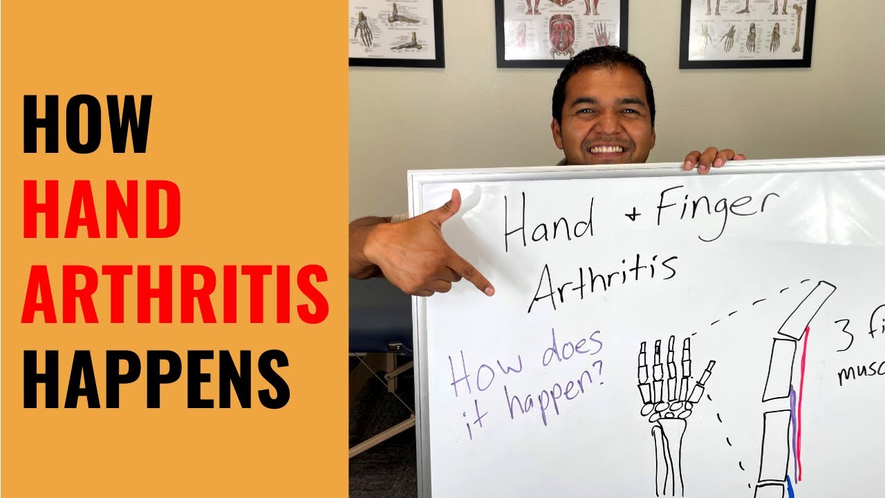 How Hand Arthritis Happens