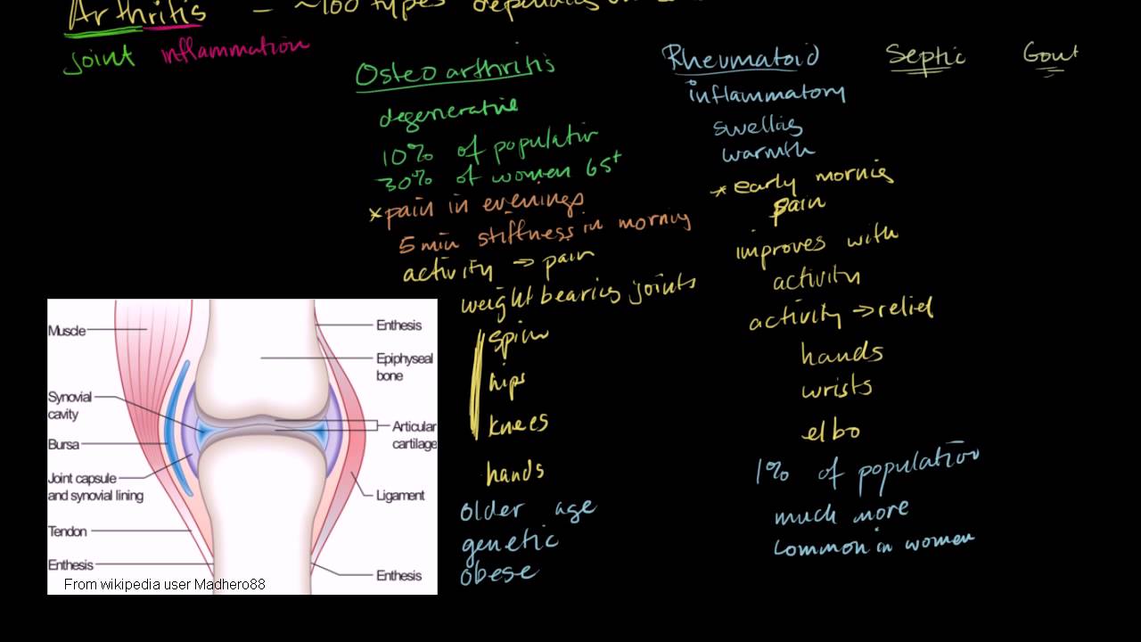 Osteoarthritis and rheumatoid arthritis