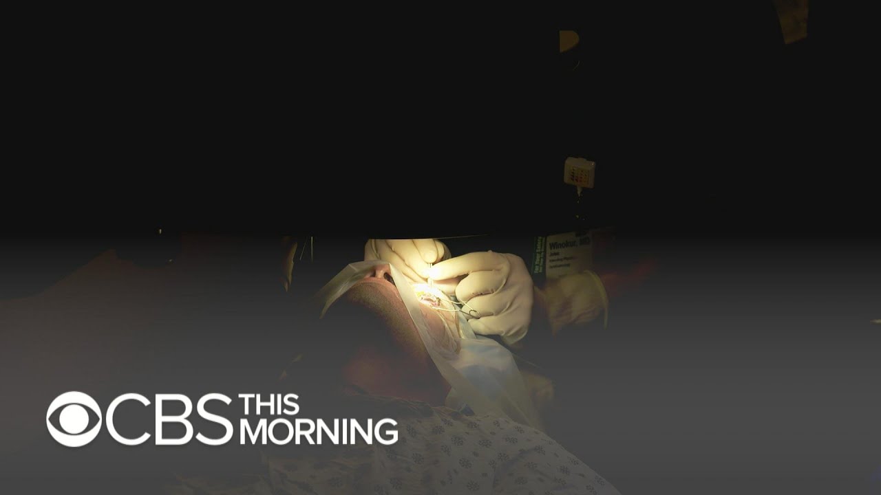 LASIK eye surgery should be taken off market, former FDA adviser says