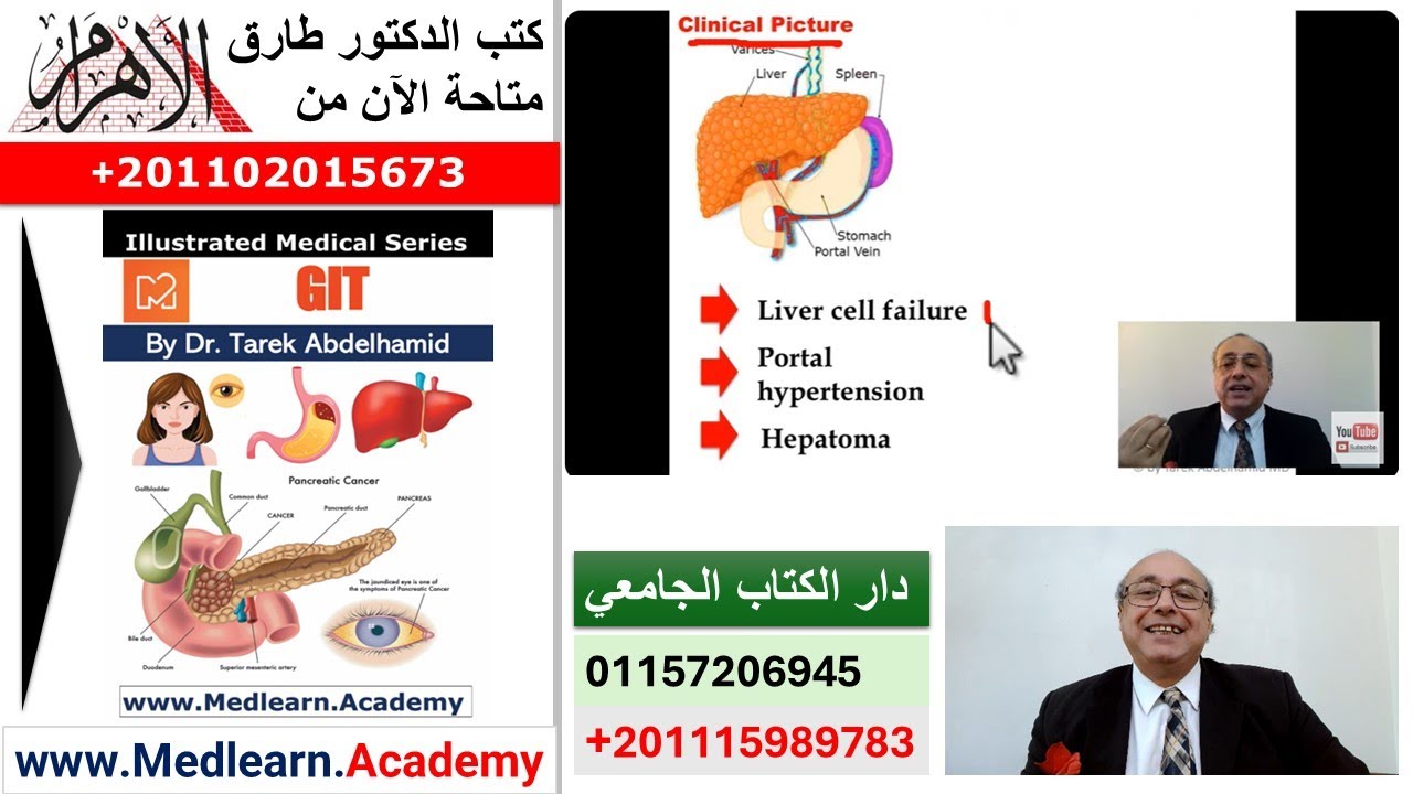 Liver Cirrhosis [1]  #internal_medicine #cme #medicaleducation #ecg #محاضرات_باطنة #medical
