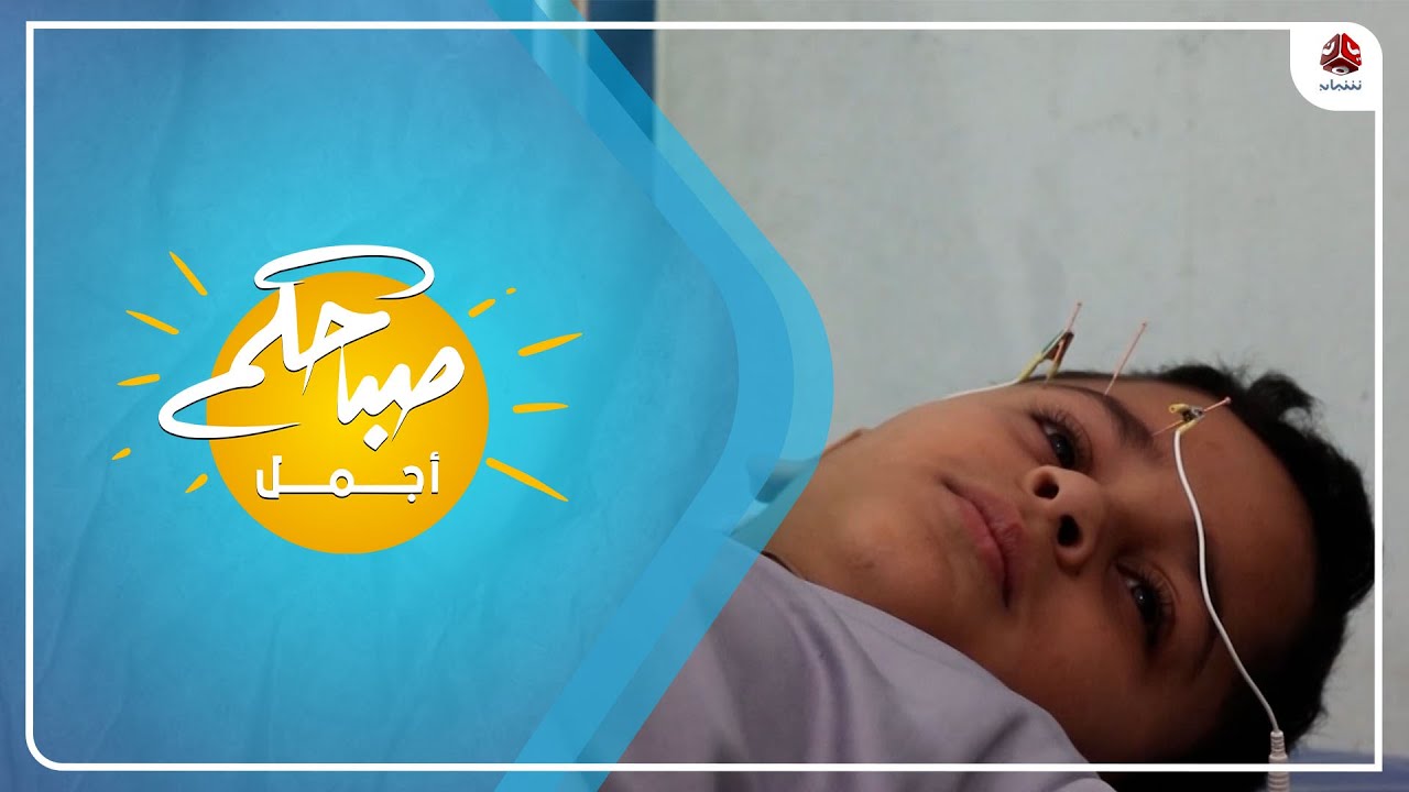 العلاج باستخدام بالابر الصينية .. أحدث طرق الطب البديل