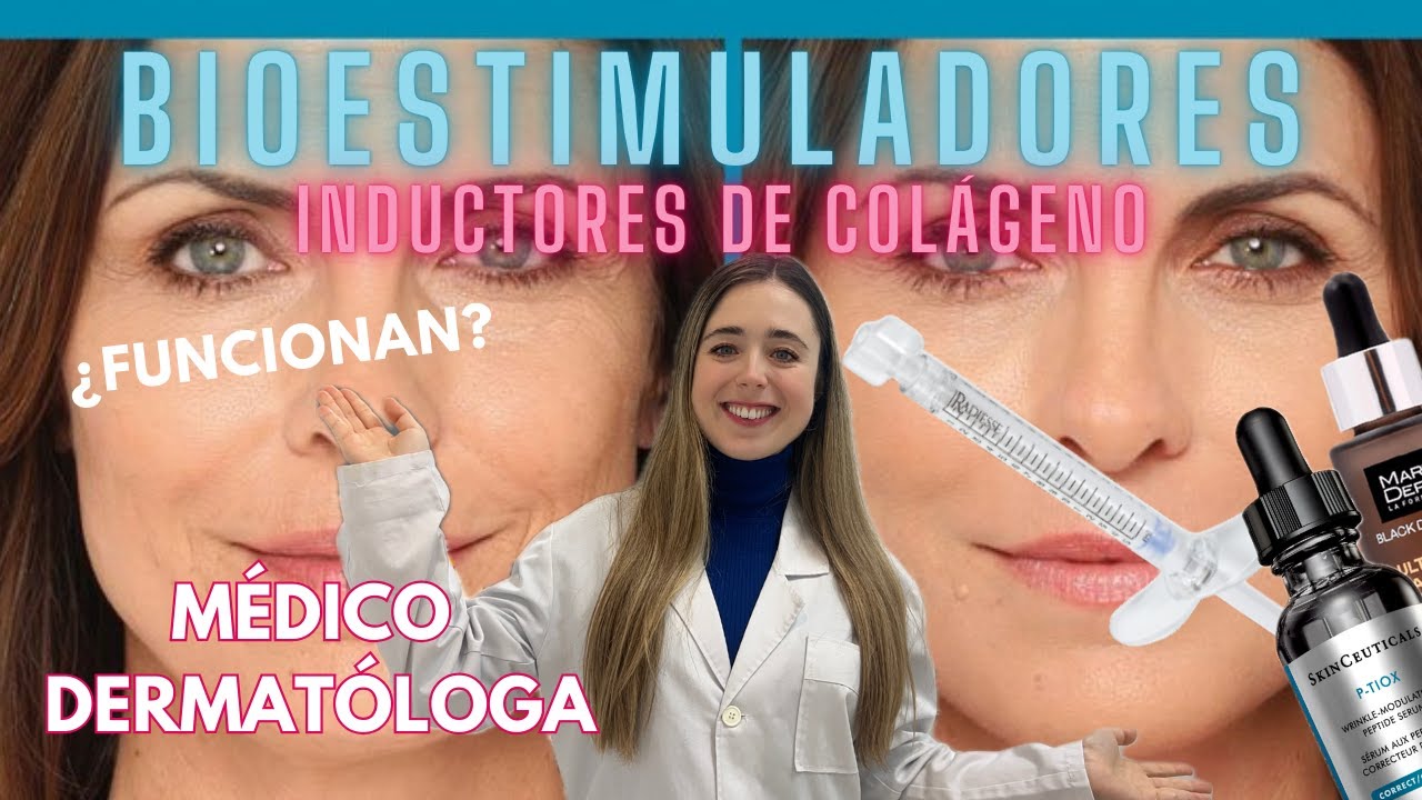 BIOESTIMULADORES O INDUCTORES DE COLÁGENO: ¿FUNCIONAN? DERMATÓLOGA EXPLICA SCULPTRA, RADIESSE...