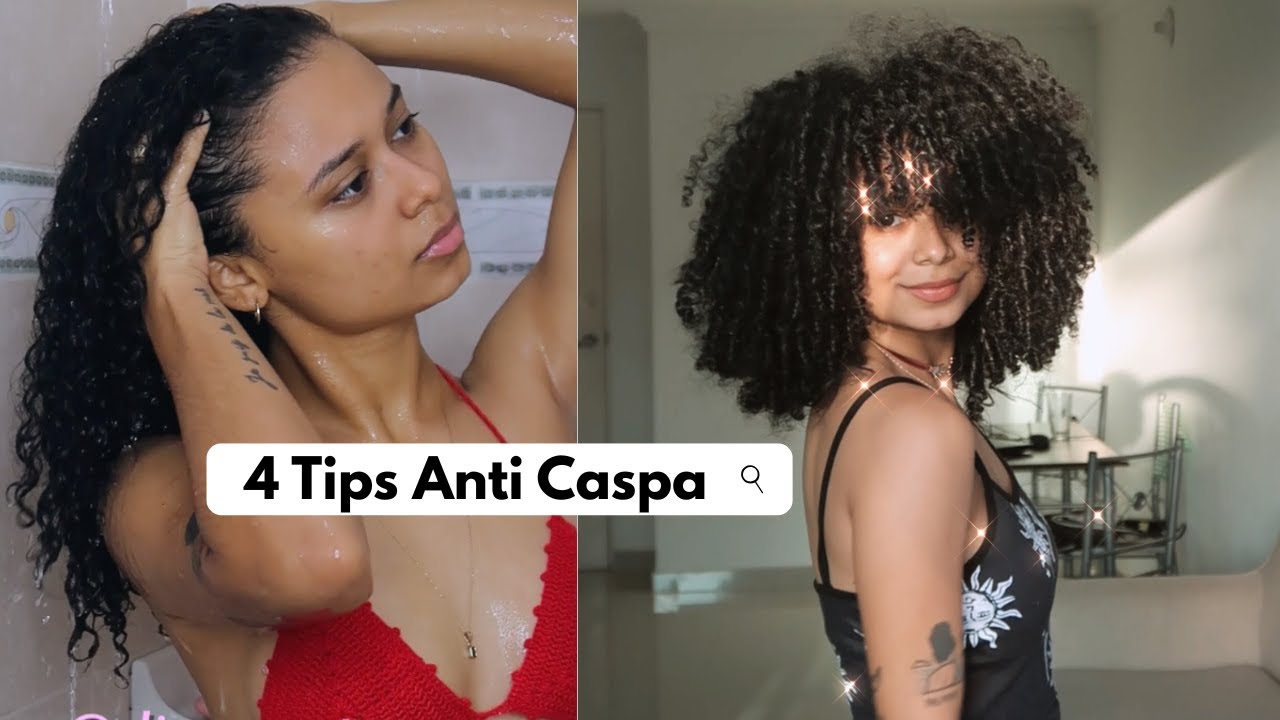 ASÍ ELIMINÉ LA CASPA - 4 Consejos anti CASPA 🌴 Diana Petro