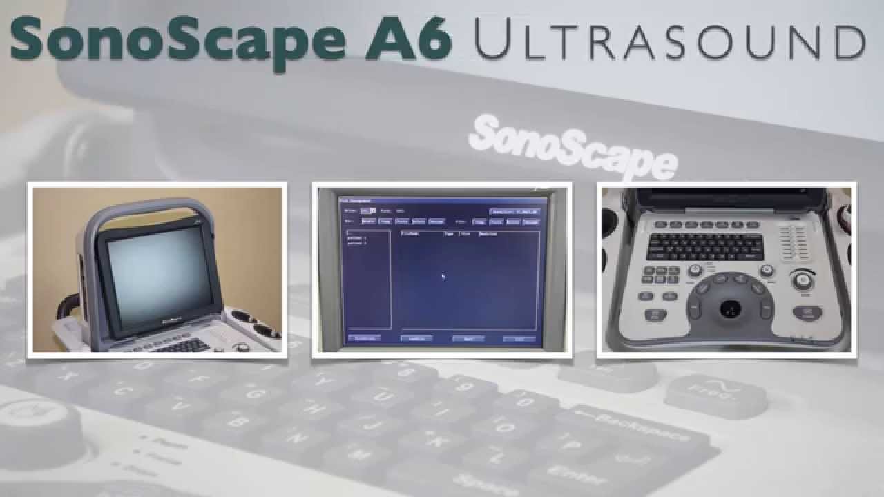 SonoScape A6 | Transferring Images to USB, How to Save Images to U Disk