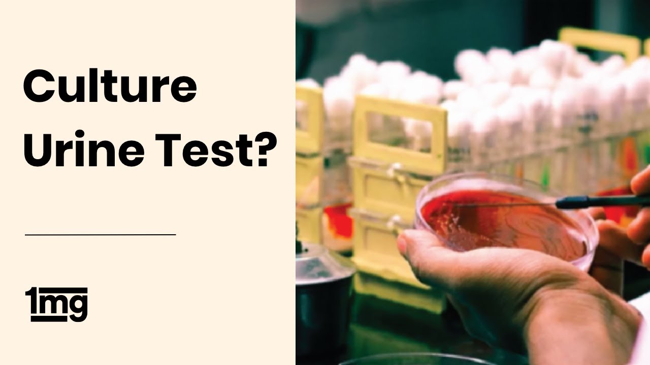 What is Urine Culture Test? | 1mg