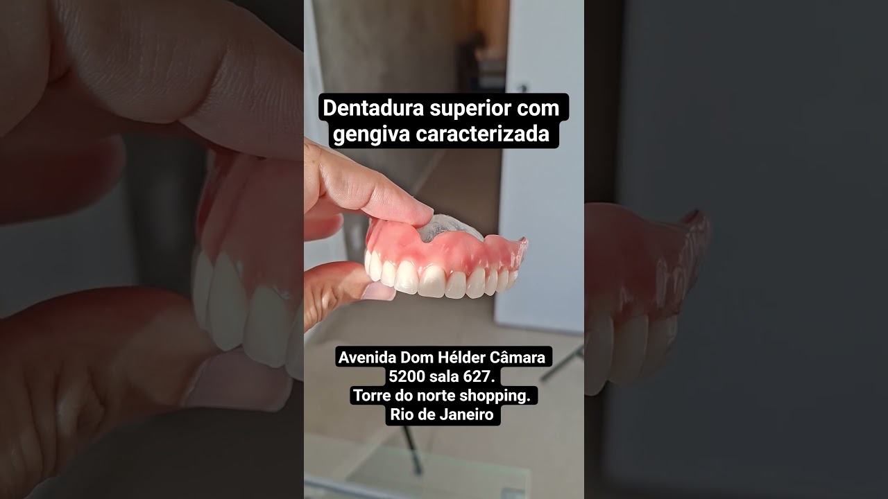 Dentadura superior com gengiva caracterizada. #dentadura #dentistarj #torrenorteshopping