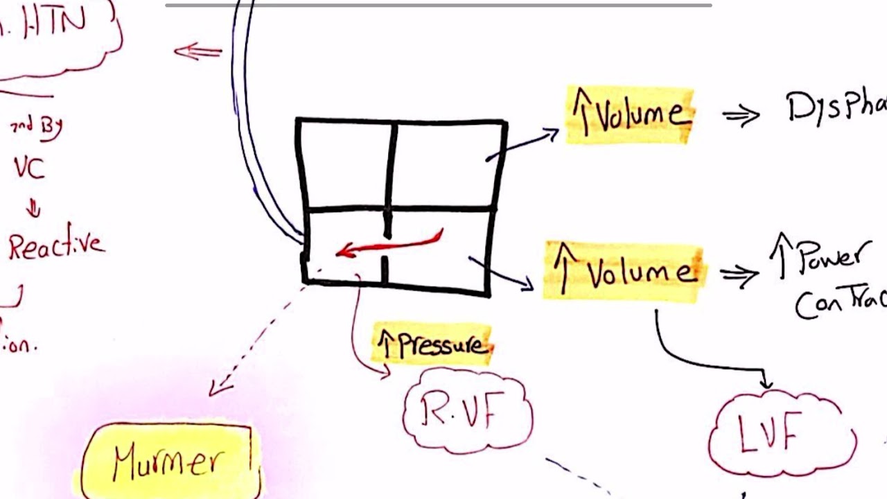 Pediatrics - Cardiology - 1) VSD